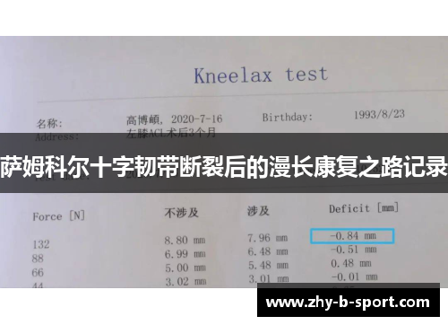 萨姆科尔十字韧带断裂后的漫长康复之路记录 萨姆科尔十字韧带断裂后的漫长康复之路记录